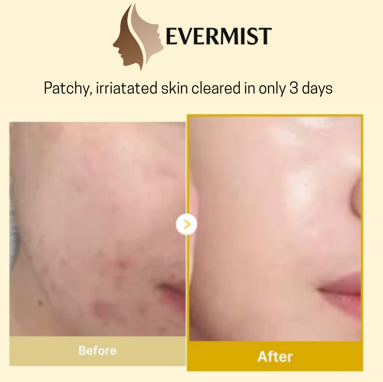 EVERMIST Turmeric + Collagen Kojic Acid Night Mask